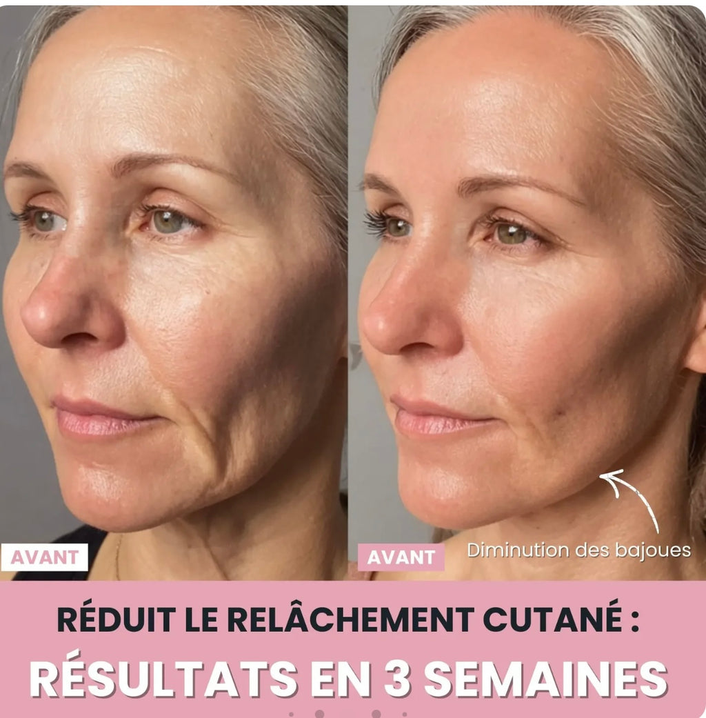 Sculpteur Facial