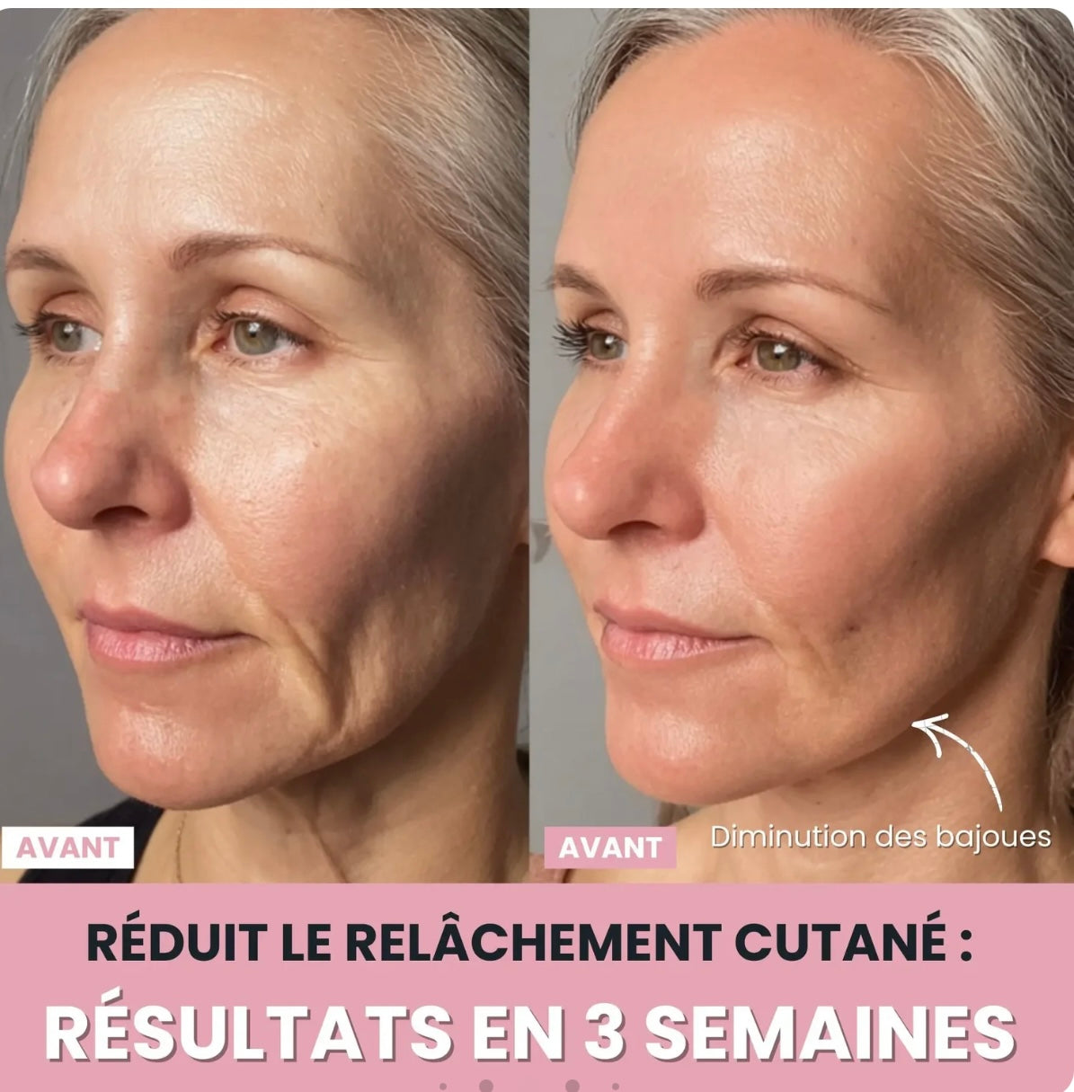 Sculpteur Facial